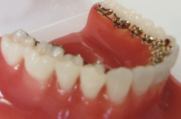 �����K���u���P�b�g(�㑤�����j