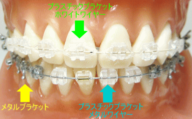 �������u